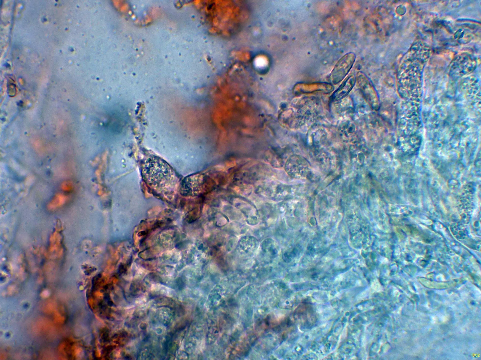Microscopía de Ramaria botrytis - 10 - Basidios-002